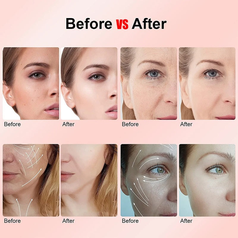 RF Radio Frequency Skin Tightening Beauty Device, Anti-Aging Face Machine for Wrinkle Removal, Lifting & Firming, Microcurrent Facial Device, Light Therapy Beauty Massager