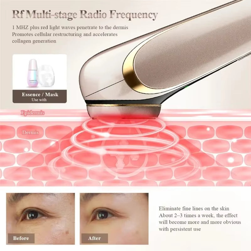 4 in 1 RF Facial Lifting and Firming Rejuvenation Skin Tightening Beauty device Home Use Face device EMS Microcurrent Beauty Instrument