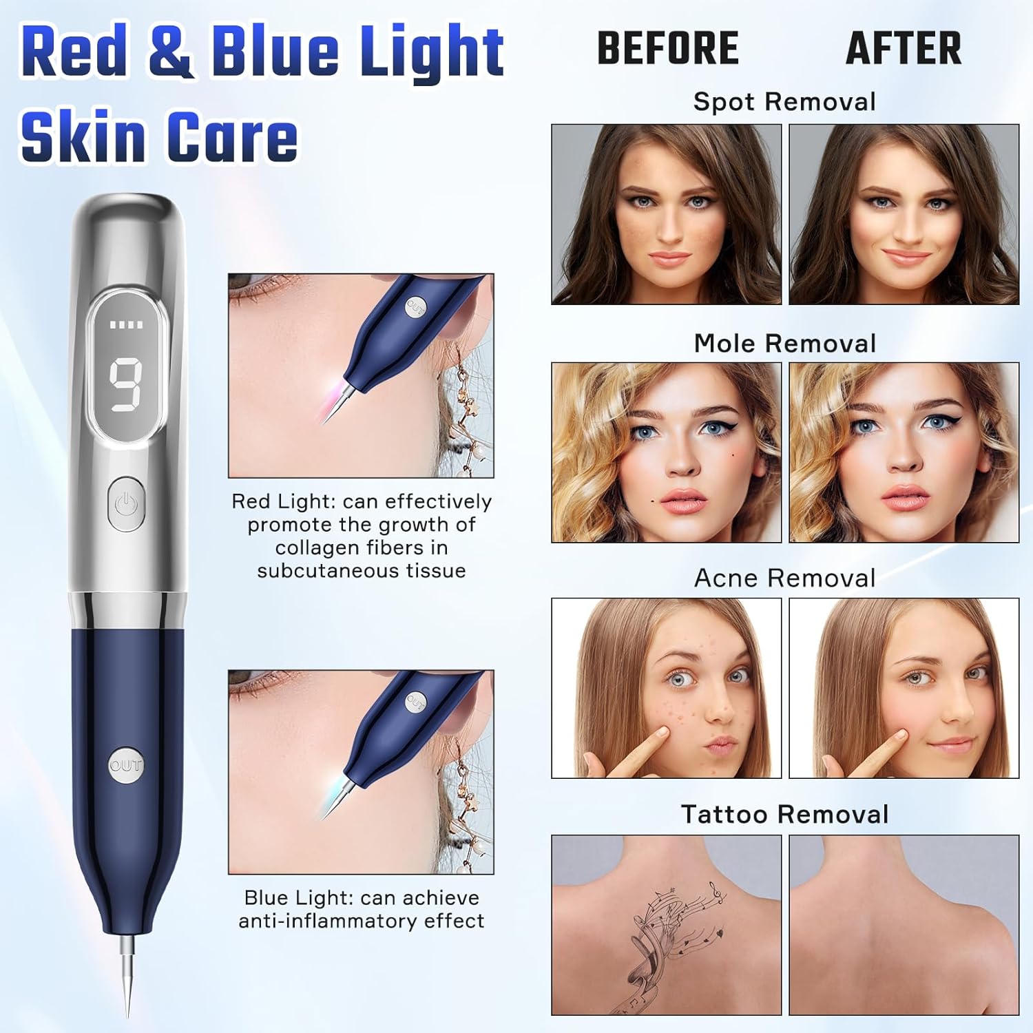 Skin Tags Remover Kit, Mole Pen Removal Kit with 9 Adjustable Modes, Plasma Pen for Warts, Spot, Body Facial, Freckle, Nevus