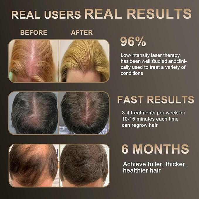 Laser Hair Growth Comb - Laser Light Therapy for Hair Growth, Handheld Scalp Laser Device for Thicker, Healthier Hair, Medical Grade Hair Loss Treatment Regrows Fuller and Thickness, Stimulates Growth for Men & Women