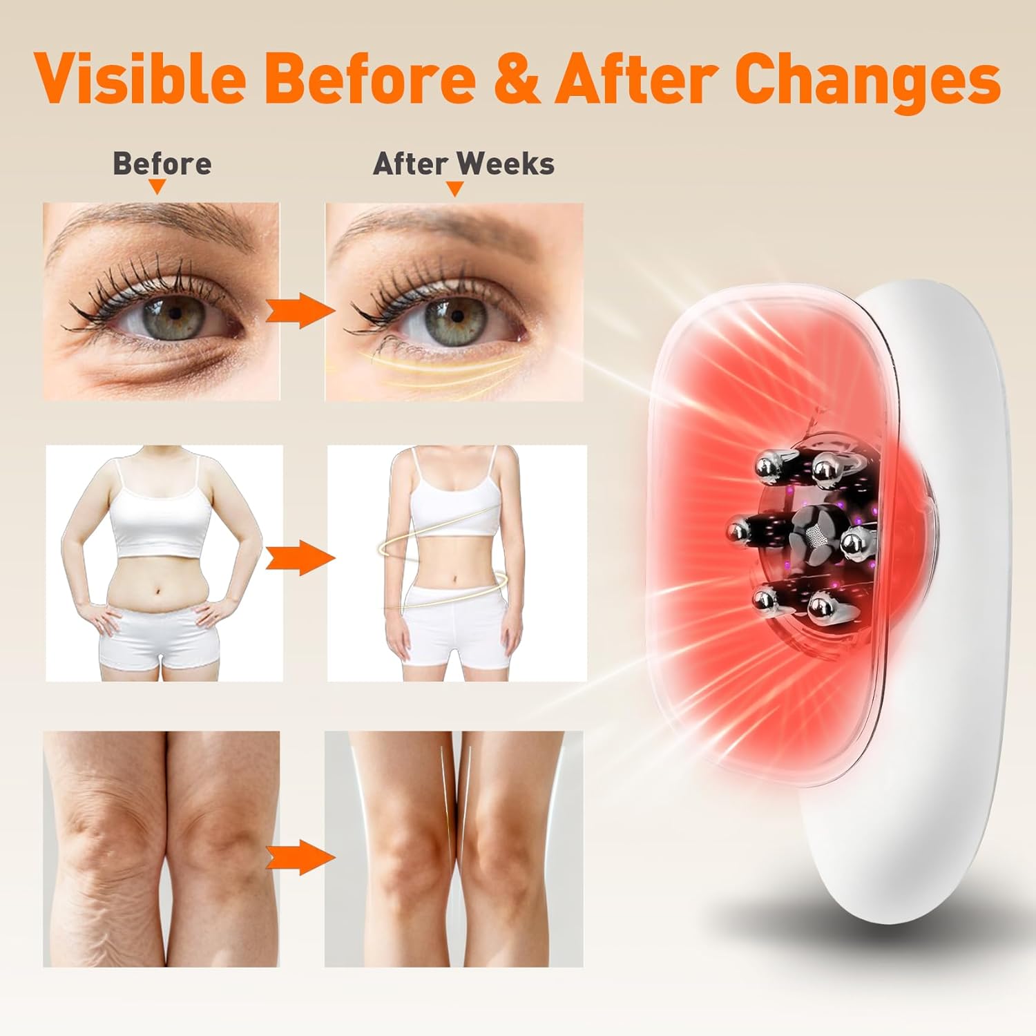 5-in-1 Body Sculpting Machine - Best Cellulite Removal Machine – Lymphatic Drainage Massager, Anti Cellulite Massage Tool & Skin Tightening for Face, Belly, Arms, Legs, Waist, Love Handles