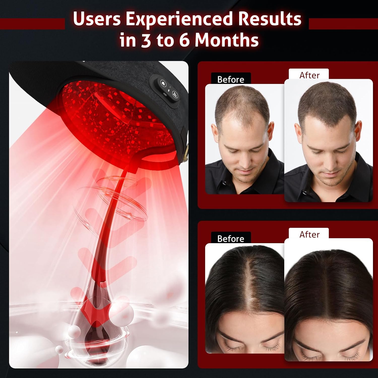 Wireless Laser Cap for Hair Growth, Red Light Therapy for Hair Growth, Laser Hair Growth Cap,  Strengthen Hair Roots, Scalp Treatment to Stop Hair Loss and Regrows Thinning Hair, Hair Loss Treatment for Men and Women